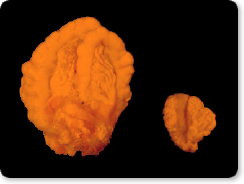 Exposure to phthalate in womb causes harm