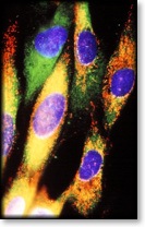 Cytomegalovirus infection mitochondria excitotoxic immunofluorescence