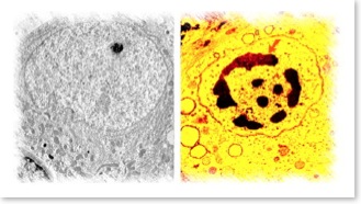 Excitotoxic cell death apoptosis